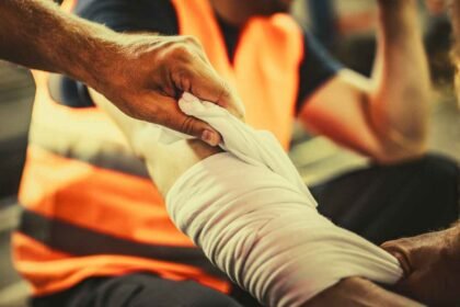 Burn Injury Attorney